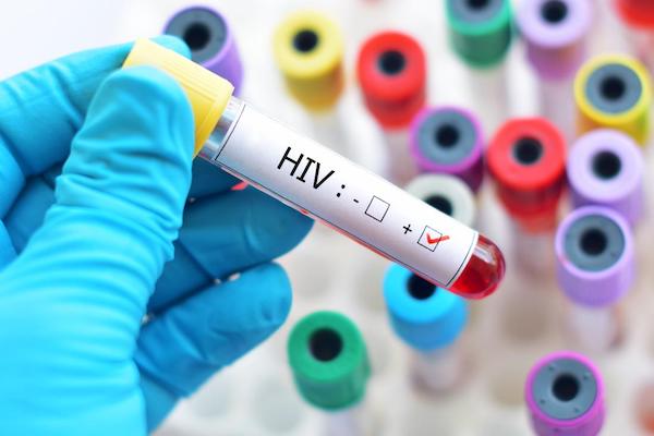 主に「HIV陽性に気付いていない人」がHIVを感染させている（米調査）